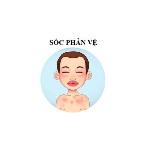 Sốc