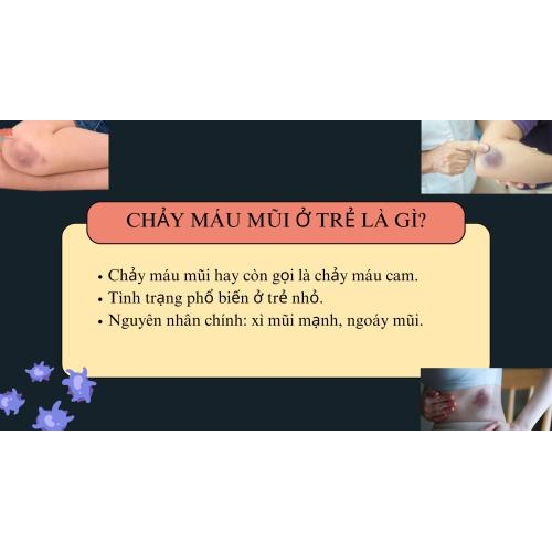Chảy Máu mũi Ở Trẻ Là Gì?